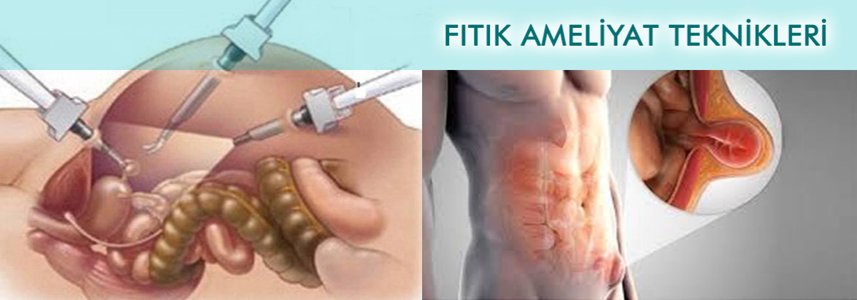 FITIK AMELİYAT TEKNİKLERİ